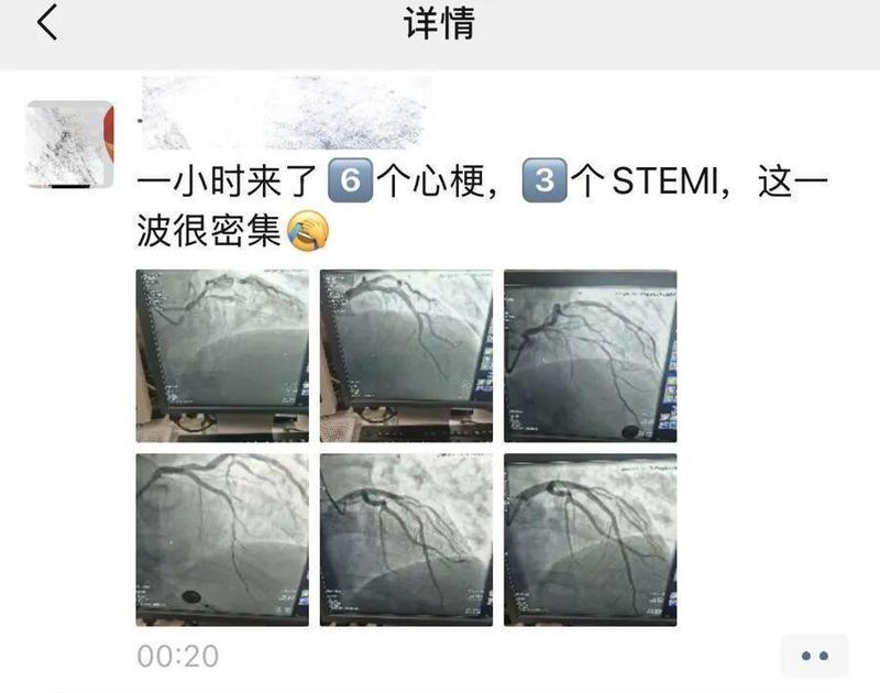  别让心脏在奔跑中停摆：一份给忙碌者的救命指南 健康养生